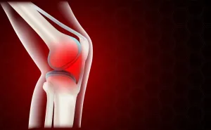 Proposed Peripheral Nerve Block LCD - graphic of a painful knee